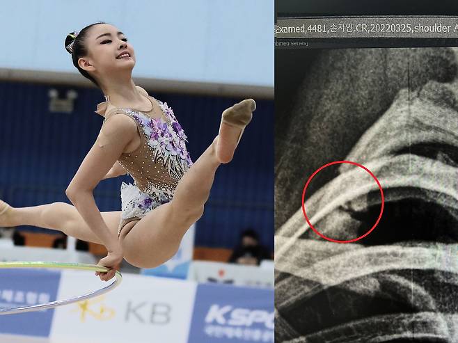 손지인 선수© 뉴스1