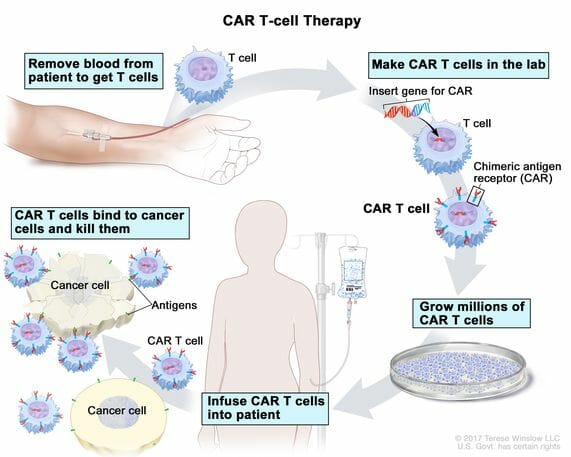 CAR-T 치료법 개념도 (자료=미국 국립암연구소)