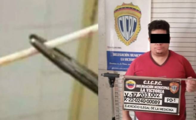 의사 행세를 하다가 붙잡힌 남자. 왼쪽은 남자가 피임시술에 사용한 아이스크림 막대.베네수엘라 경찰