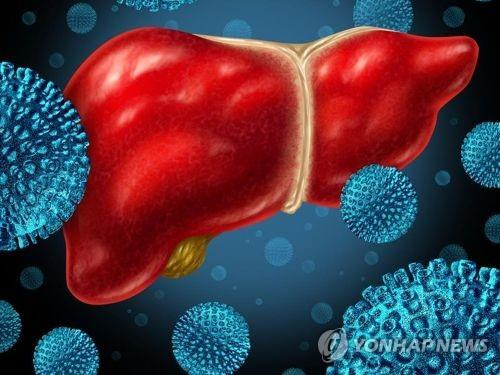 간염  [게티이미지뱅크 제공, 재판매 및 DB금지]
