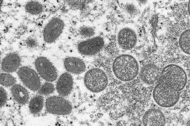 미국 질병통제예방센터가 공개한 전자현미경 사진에 인간의 피부 샘플에서 얻은 성숙된 타원형의 원숭이두창 바이러스(왼쪽)와  구형의 미성숙 바이러스(오른쪽)가 나타나고 있다. 연합뉴스·AP