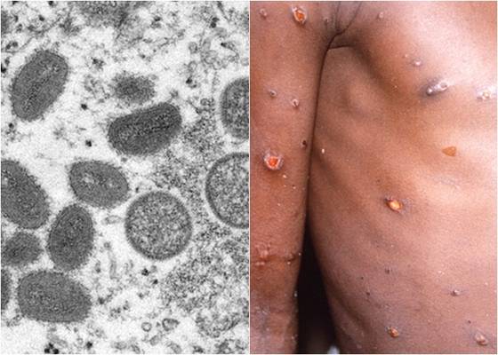 〈자료사진=REUTERS 연합뉴스〉