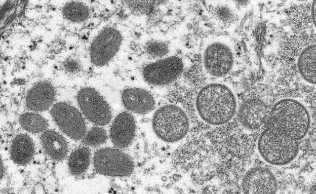미국 질병통제예방센터에서 공개한 원숭이두창 바이러스를 현미경으로 관찰한 모습. 로이터 연합뉴스