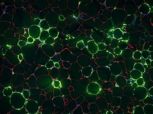 염증이 생긴 지방조직 비만한 생쥐의 염증성 면역세포(녹색)가 지방세포(적색)를 둘러싸고 있다.
[미국 UTSW(텍사스대 사우스웨스턴 메디컬 센터) 제공. 재판매 및 DB 금지]