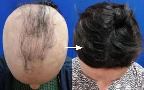 〈사진=콘서트 파마슈티컬스〉