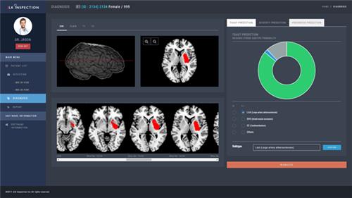 제이엘케이의 인공지능 기반 뇌경색 분석 솔루션 JBS-01K [제이엘케이 제공. 재판매 및 DB 금지]