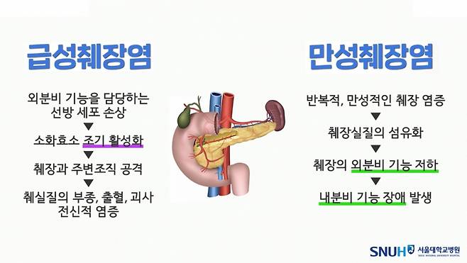 급성 췌장염과 만성 췌장염의 차이/사진제공=서울대학교병원
