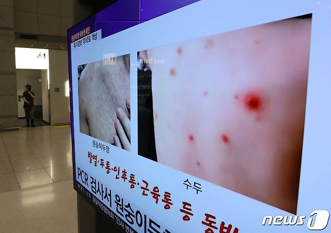 국내 첫 원숭이두창 확진자가 발생한 가운데 해외 입국자가 급증하면서 추가 유입 우려가 커지고 있다. 23일 인천공항 제1터미널 입국장 TV에 원숭이두창 관련 뉴스가 나오고 있다. 2022.6.23/뉴스1 © News1 이성철 기자