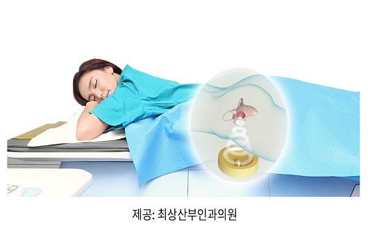 하이푸｜출처: 최상산부인과의원