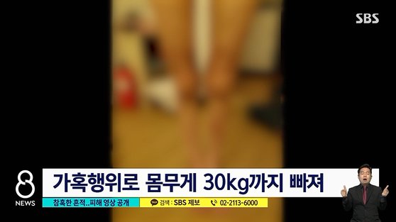 강원도 원주의 한 유흥업소에서 일하는 종업원들이 감금 생활 중 촬영한 몸 상태. [SBS 뉴스8 방송화면 캡처]