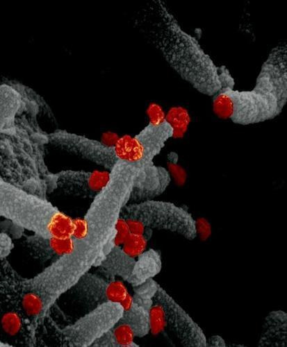 신종 코로나바이러스  배양 세포의 표면에서 빠져나오는 신종 코로나바이러스(적색)의 주사형 전자현미경 이미지.
[미국 국립 알레르기 감염병 연구소(NIAID). 재판매 및 DB 금지]