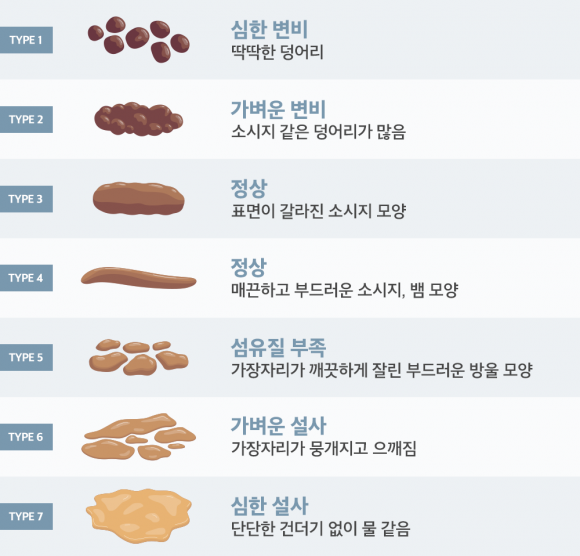 브리스톨 대변 척도. [참고=참 쉬운 의학용어사전 / 그래픽=최소연 디자이너]