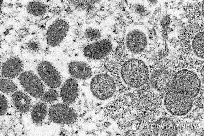 원숭이두창 [CDC via AP 연합뉴스 자료사진. 재판매 및 DB 금지]