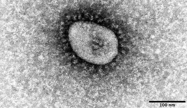 코로나19 오미크론 변이주 전자현미경 사진. 사진제공=일본 국립감염증연구소