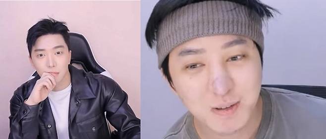 유튜버 강학두씨의 예전 모습과 이번 코 성형 후 염증으로 코가 부푼 모습. (강학두 제공) ⓒ 뉴스1