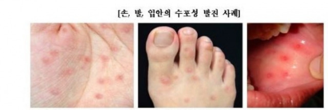 질병관리청 제공
