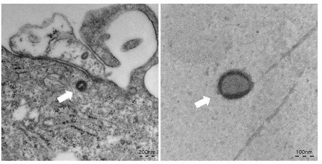 원숭이두창 바이러스 분리주를 전자 현미경으로 촬영한 사진. 질병관리청 제공