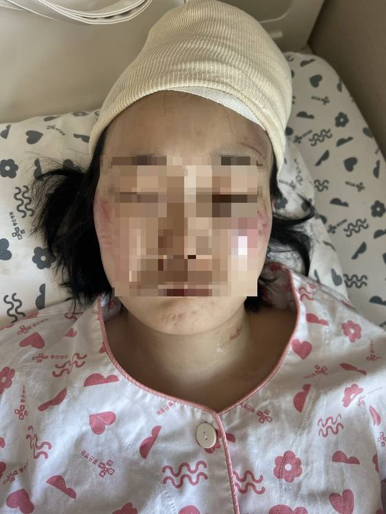 입원 당시 A 씨 (사진제공 : A 씨)