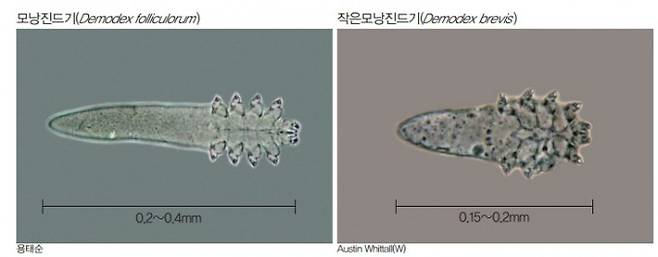 사람에서 발견된 모낭충은 ‘모낭진드기’와 ‘작은모낭진드기’ 두 종이다. 모낭진드기는 모낭의 깔때기처럼 생긴 부분에서 집단을 이뤄서 서식하고, 작은모낭진드기는 피지선에 독립적으로 서식한다. 이런 탓에 작은모낭진드기를 발견하기는 더 어렵다. 어린이과학동아DB