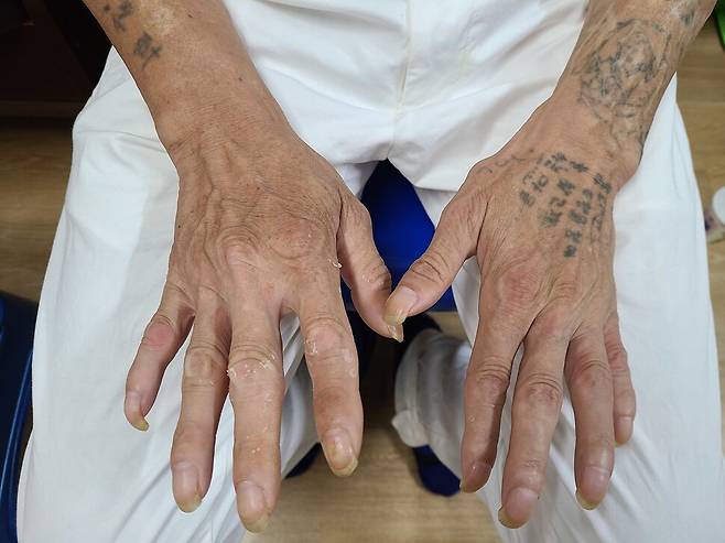 문신이 새겨진 김석진(가명·58)씨의 손.