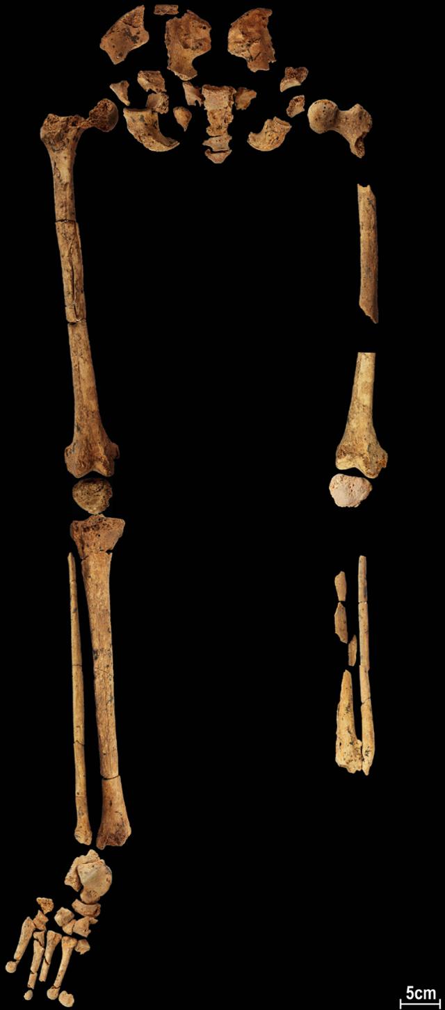 인도네시아 동굴에서 발견된 유골의 왼발과 왼 종아리 아랫부분의 뼈가 절단되어 있다. 팀 멜로니 박사 연구팀 제공