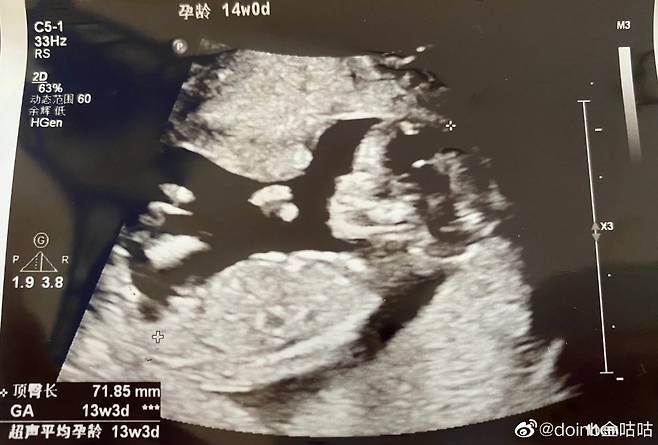 사진='도인비' SNS.