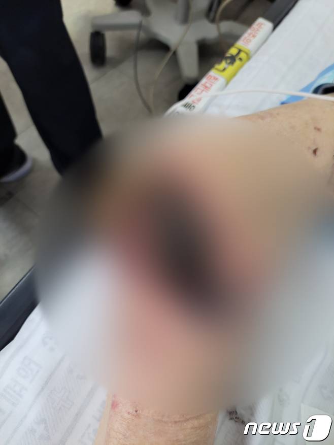 학대와 방임 의혹이 제기된 서귀포공립요양원 입소자의 무릎 사진.(제주도청 게시판 갈무리)