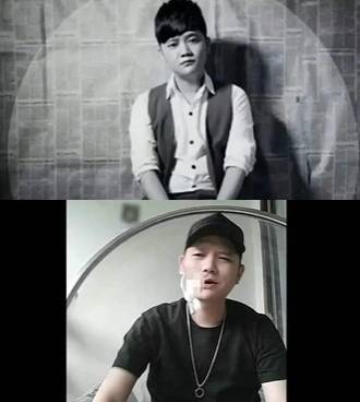 빈랑 섭취로 구강암을 앓다가 세상을 떠난 가수 보송. (트위터)