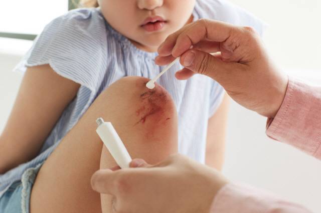 찰과상이 생겼다면 상처가 생긴 직후 소독약으로 1~2회 소독하고, 상처가 빨갛게 부어있다면 항생제 연고를 발라주는 게 좋다./사진=클립아트코리아