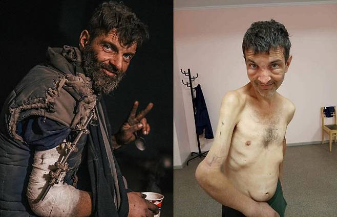 러시아군에 포로로 잡혔다가 4개월 만에 풀려난 우크라이나 군인 미하일로 디아노프(42)의 끔찍한 몸 상태가 공개됐다. (사진=페이스북, 우크라이나 국방부)