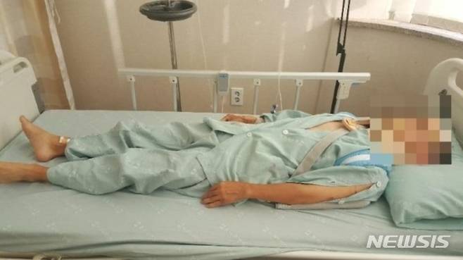 [서울=뉴시스]서울 신도림 역에서 인근에서 아버지가 지나가던 전동킥보드에 치여 큰 부상을 입었는데 가해자는 도망갔다며 목격자를 찾는다는 사연이 공개됐다.2022.09.28.(사진=온라인 커뮤니티 캡쳐)photo@newsis.com