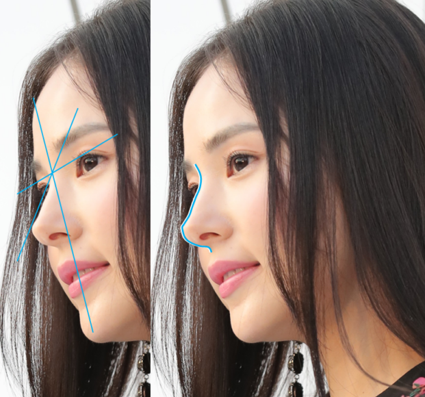 성형외과 의사들이 코가 예쁜 여자로 꼽은 민효린의  옆 얼굴 모습,