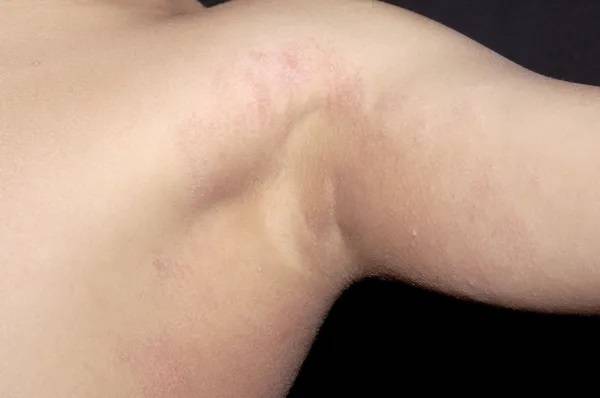 비만은 여러 피부질환을 유발할 수 있지만 체중만 감량하면 증상은 완화될 가능성이 크다./사진=클립아트코리아