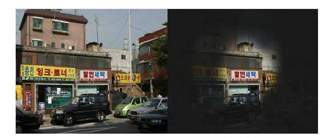 정상안과 시야 협착 비교.&nbsp; &nbsp;사단법인 한국망막변성협회