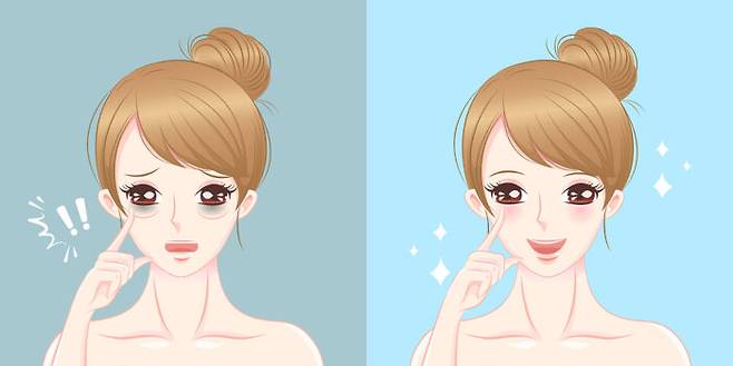 눈밑 다크서클은 휴식을 충분히 취하는 등의 방법으로 개선할 수 있다. [사진=클립아트코리아]