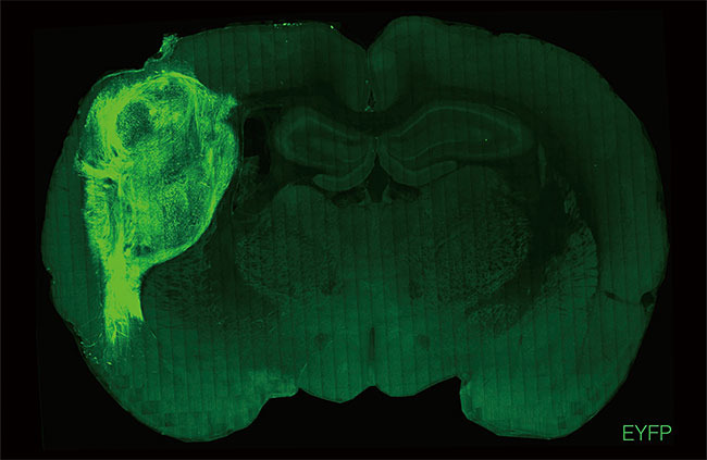 쥐의 뇌에 이식한 인간 미니 뇌가 형광 녹색으로 빛나고 있다. 미니 뇌는 쥐 뇌의 한쪽 반구에서 거의 3분의 1을 차지했다. 사진 스탠퍼드대