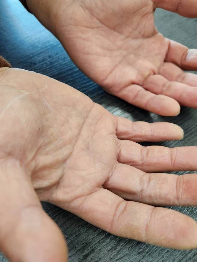 평소에는 잘 몰랐는데 사진 찍어 보니 손이 제법 거칠어졌다. 사진=임송