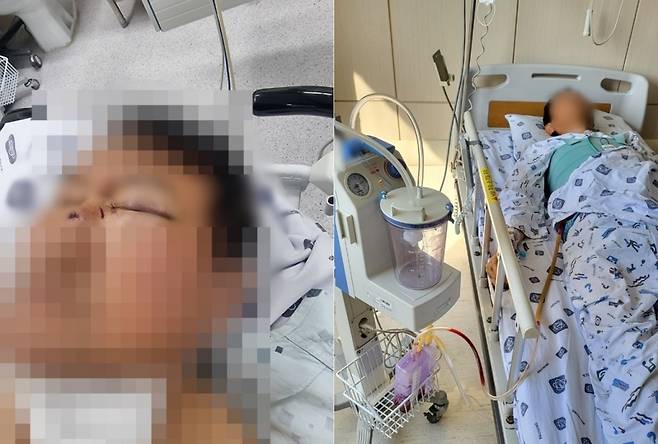 지난 24일 경북 김천시 율곡동 인근 대로변에서 20대 남성에게 폭행을 당한 70대 남성 B씨가 병원에 입원한 모습. /사진=독자 제공