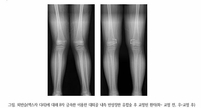 [분당서울대병원 제공]