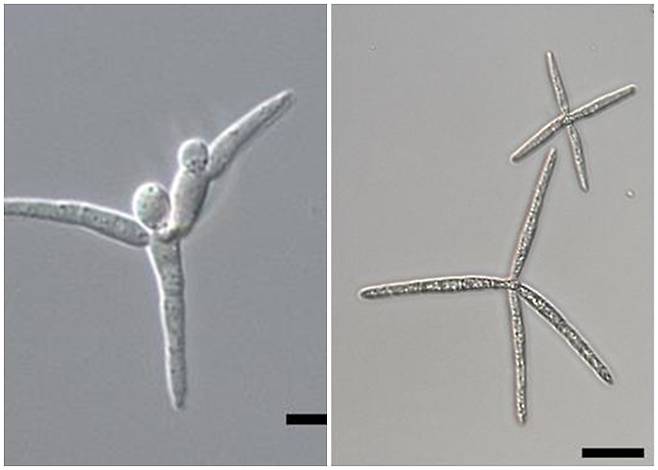 [서울=뉴시스] 왼쪽부터 테트라클라디움 프락시네움(Tetracladium fraxineum), 레모니에라 프락시네아(Lemonniera fraxinea) 포자모양(사진=국립낙동강생물자원관 제공) *재판매 및 DB 금지 *재판매 및 DB 금지