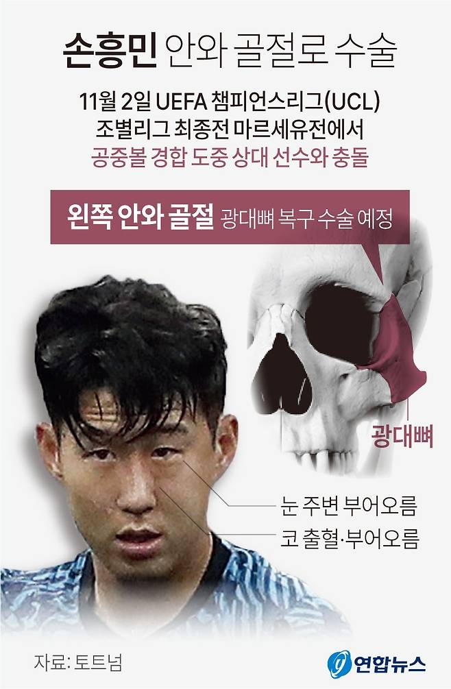 잉글랜드 프로축구 토트넘은 3일(한국시간) 홈페이지를 통해 손흥민이 안와 골절로 수술을 받게 됐다고 밝혔다. 연합뉴스