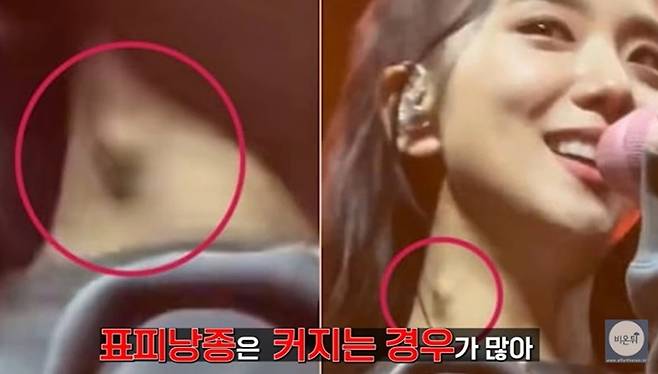 [사진=유튜브 비온뒤 채널 캡처]