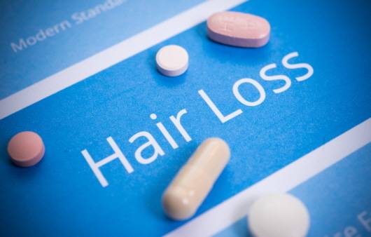 탈모ㅣ출처: 게티 이미지뱅크