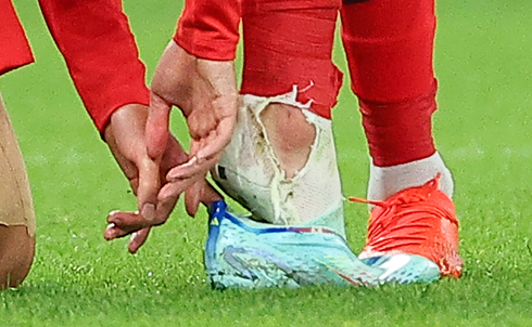 24일 오후(현지시간) 카타르 알라이얀의 에듀케이션 시티 스타디움에서 열린 2022 카타르 월드컵 조별리그 H조 1차전 대한민국과 우루과이 경기. 대한민국의 손흥민이 우루과이의 카세레스의 거친 태클에 넘어진 뒤 축구화를 신고 있다. 손흥민의 오른쪽 양말이 찢겨져 있다. 연합뉴스