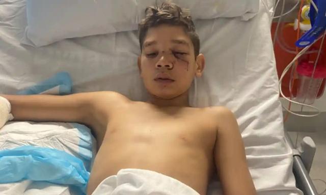 지난 13일, 호주 퍼스 지역에서 13세 소년 제이든 에이브러햄 군이 경찰견에게 물린 뒤 병원에 입원한 모습. 호주 가디언 캡처