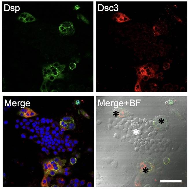 세포 리프로그래밍 과정 중 일시적으로 형성되는 중간단계세포에 데스모솜 단백질을 염색한 후 공초점 현미경으로 관찰한 사진.[한국생명공학연구원 제공]
