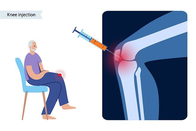 ‘퇴행성 관절염’의 통증 완화를 위해 주입하는 ‘코르티코스테로이드’ 주사가 오히려 관절염을 더 악화시킬 수 있다는 연구 결과가 나왔다. 게티이미지뱅크