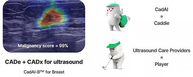 초음파 유방암 실시간 인공지능 진단 시스템 ‘캐디-B(CadAI-B)’. (대구시 제공) 2022.12.07