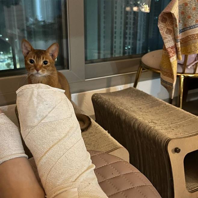 가수 장재인이 공개한 화상 치료 중인 발 사진./사진=장재인 인스타그램