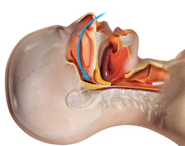 상기도저항증후군을 앓고 있다면 입을 벌리고 잘 수 있다./사진=클립아트코리아